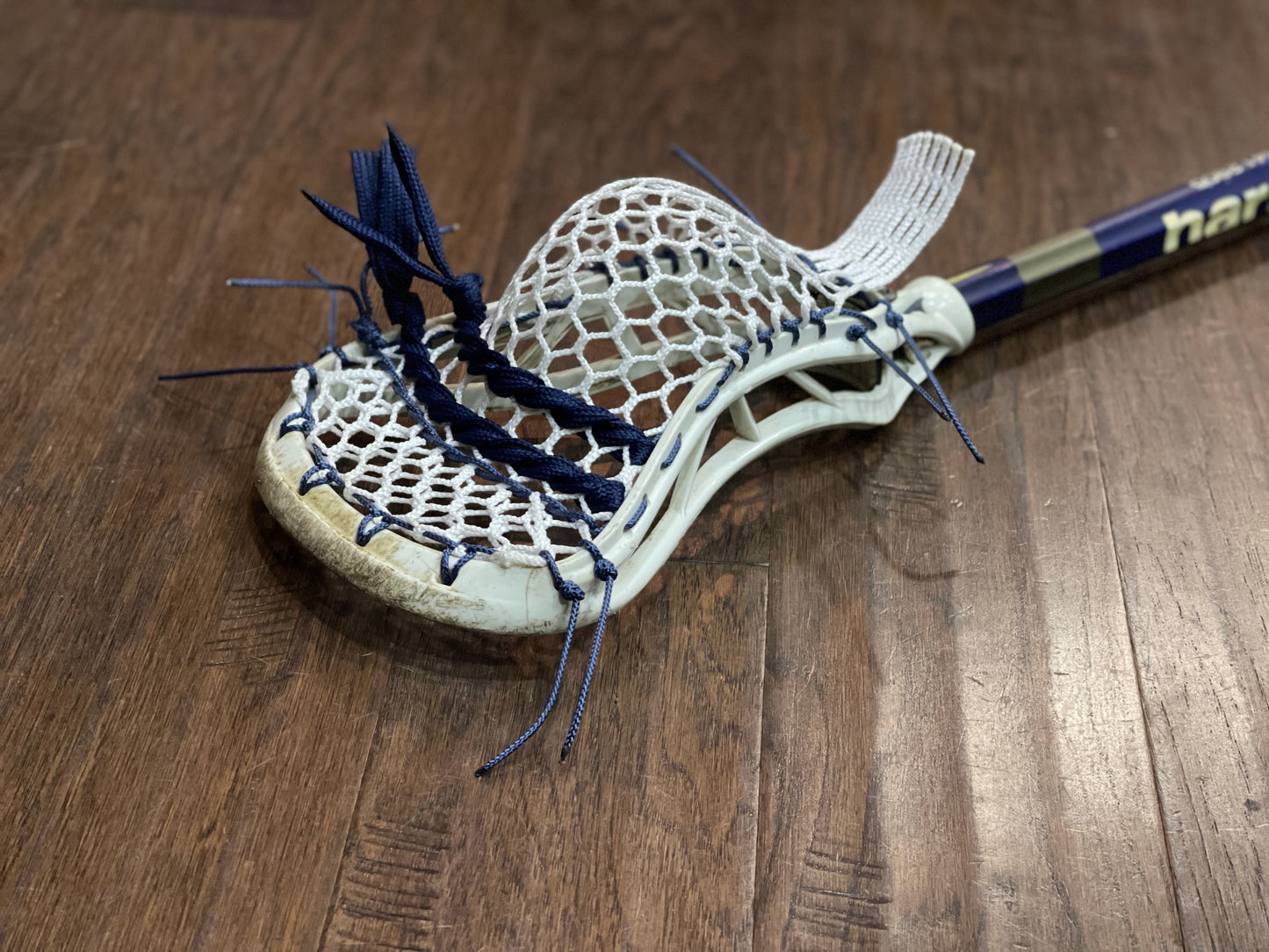 Build Your Own | Field | Pocket Restoration