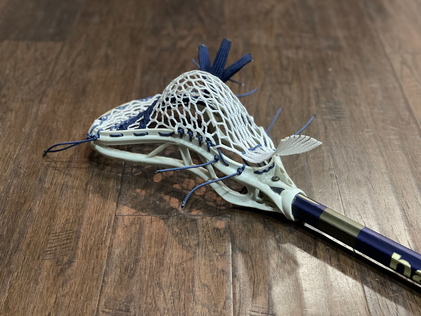 Build Your Own | Field | Pocket Restoration