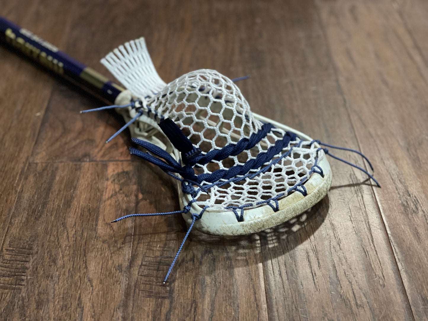 Build Your Own | Field | Pocket Restoration